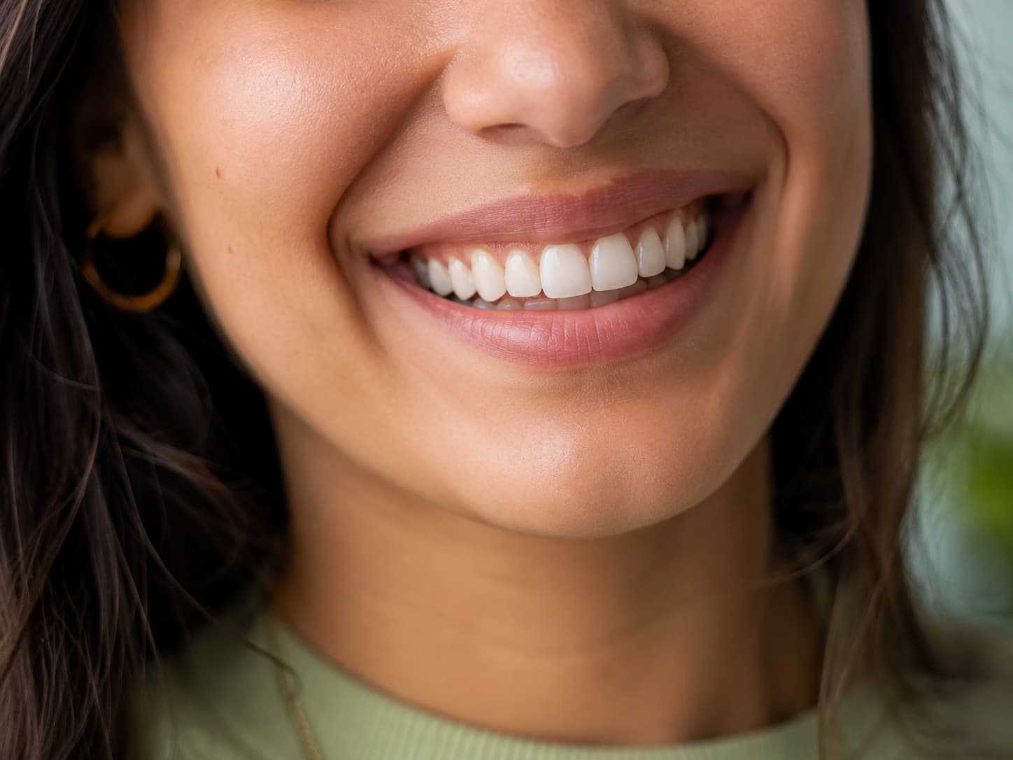 Bright smile after teeth whitening treatment at Elysian Dental Care, Kondapur