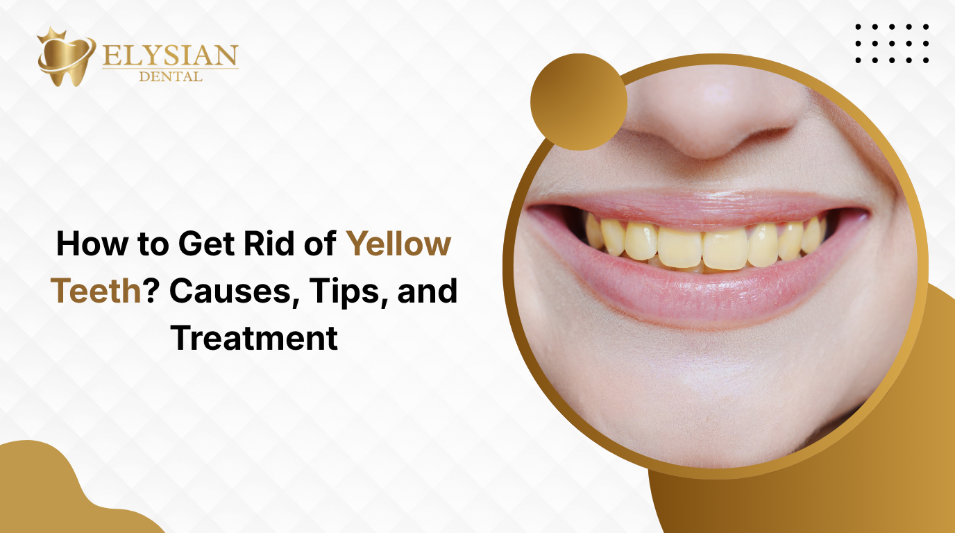 How to Get Rid of Yellow Teeth? Causes, Tips, and Treatment