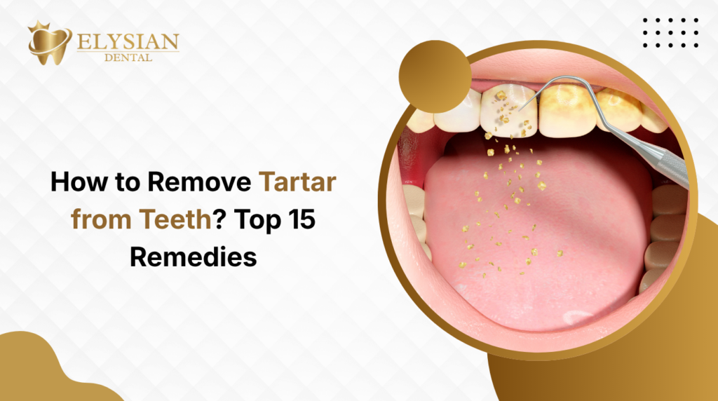 Tartar from Teeth